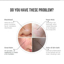 V100 AI Intelligent Visible Electric Blackhead Suction Instrument Pore Cleaner(Pink)