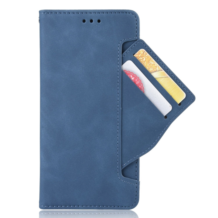 For Rakuten BIG S Skin Feel Calf Pattern Horizontal Flip Leather Case with Holder & Card Slots & Photo Frame(Blue)