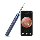 X1 WiFi Smart Visual Ear Pick HD Digital Ear Endoscope(Blue)