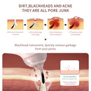 505 Household Electric Acne Blackhead Meter Export Instrument Pore Cleaner (Black White)