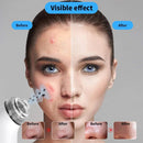 505 Household Electric Acne Blackhead Meter Export Instrument Pore Cleaner (Pink)