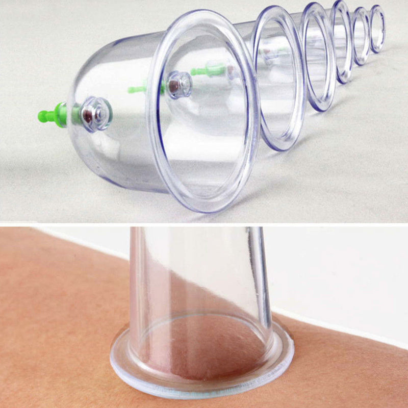 6 pcs Medical Chinese Vacuum Body Cupping Set Massage Therapy Suction Cup Best