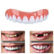 1 Piece For Smile Perfect Snap Top Instant Cosmetic Teeth Cover Whitening Braces