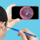 3.9mm 1.0MP HD Wifi Visual Otoscope Digital Endoscope with 6 LED Lights