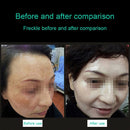 Handheld Picosecond Portable ( Removing Eyebrows Tattoo Spot) Machine Laser Plasma Beauty Care Pen, US Plug(Red Light)