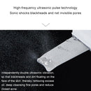 2W Ultrasonic Vibration Face Cleansing Machine Dead Skin Cleaner Scrubber Shovel Tool Face Beauty Instrument (White)