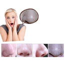 5W 1A Multi-function Blackhead Extractor Pore Cleanser with Four Probes (Blue)