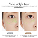 Original Xiaomi Youpin WX-SP301 wellskins Radio Frequency Beauty Instrument