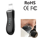 BLK-D016 Ultrasonic Beauty Shovel Skin Machine Vibration Household Facial Cleaning and Washing Massage Instrument Beauty Instrument(Black)