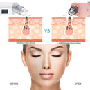 K-SKIN KD803A 3 Level Intensity Blackhead Removal Pore Cleaner Suction Rechargeable Black Spot Cleaner Facial Cleaning Machine