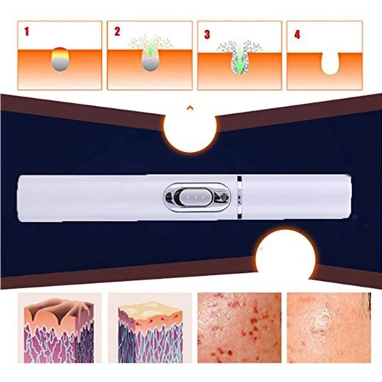 K-SKIN KD-7910 Acne Laser Pen Portable Wrinkle Removal Machine Durable Soft Scar Remover Device Blue Light Therapy Pen