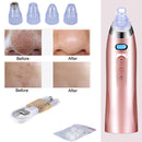 Face Pore Cleaner Blackhead Remover Vacuum Comedo Suction Diamond Dermabrasion Facial Cleaning Beauty Machine(White)