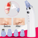 Face Pore Cleaner Blackhead Remover Vacuum Comedo Suction Diamond Dermabrasion Facial Cleaning Beauty Machine(White)