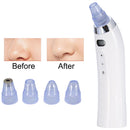 Face Pore Cleaner Blackhead Remover Vacuum Comedo Suction Diamond Dermabrasion Facial Cleaning Beauty Machine(White)