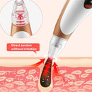 Electric Pore Cleaning Instrument Hot Compress To Export Acne Removing Blackhead Beauty Instrument(Black)