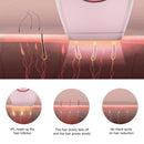 Ladies Painless Photon Laser Hair Removal Device, Specification:EU Plug(Black)