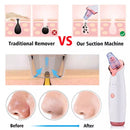 Blackhead Remover Skin Care Pore Vacuum Acne Pimple Removal Vacuum Suction Tool Facial Diamond Dermabrasion Machine Face Clean