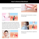 Blackhead Remover Skin Care Pore Vacuum Acne Pimple Removal Vacuum Suction Tool Facial Diamond Dermabrasion Machine Face Clean