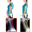 Adjustable Women Back Posture Corrector Shoulder Support Brace Belt Health Care Back Posture Belt, Size:L(White)