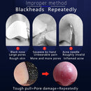 Blackhead Suction Instrument Household Pore Cleaner Beauty Instrument(White)