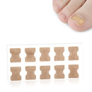 10 PCS Glue-free Orthopedic Nail Stick Toe Nail Groove Inlay Corrector(White Bottom)