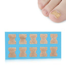 10 PCS Glue-free Orthopedic Nail Stick Toe Nail Groove Inlay Corrector(Blue Bottom)