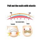 10 PCS Glue-free Orthopedic Nail Stick Toe Nail Groove Inlay Corrector(White Bottom)