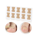 10 PCS Glue-free Orthopedic Nail Stick Toe Nail Groove Inlay Corrector(Blue Bottom)