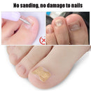 10 PCS Glue-free Orthopedic Nail Stick Toe Nail Groove Inlay Corrector(White Bottom)