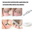 Orthopedic Buckle Toe Nail Groove Ingrown Nail Corrector, Style:No. 36, Specifications:Set