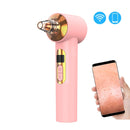 3 Millon Pixels 20 Times Magnification Intelligent Wireless Visualization Blackhead Meter Electric Pore Removal Machine,Styel: Without Cold/Hot Compress (Pink)