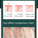 V-519 Home IPL Pulse Hair Removal Apparatus Laser Lip Armpit Hair Removal Apparatus, Style: US Plug(Emerald)