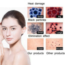 Beemyi Hand-held Mole Picosecond Pen Laser Beauty Equipment, Specification: EU Plug(PM-101 Blue Light)