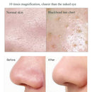 Blackhead Electric Pore Removal Machine Clean Facial Equipment,Style: Base Model