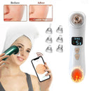 Blackhead Beauty equipment Electric Heating Pore Cleaner, Colour: Visual Heating (White)