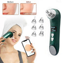 Blackhead Beauty equipment Electric Heating Pore Cleaner, Colour: Visual Heating (Green)