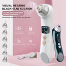 Blackhead Beauty equipment Electric Heating Pore Cleaner, Colour: Heating (Green)