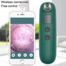 Visual Blackhead Cleaner Electric Blackhead Absorber(Green)