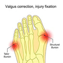 5 Pairs Wearable Shoes Big Toe Valgus Corrector Toe Comfortable Splitter(S)
