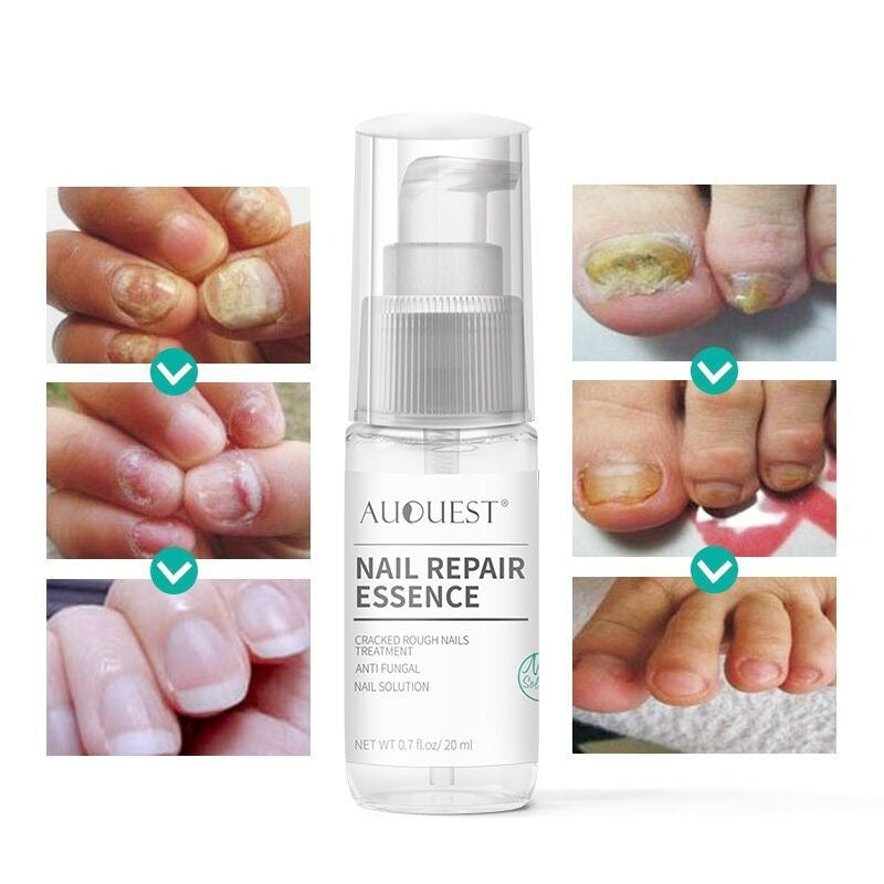 20ml Nail Repair Essence Antifungal Nail Toenail Treatment Nourishing Antifungal Nail Health Care