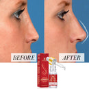 Beauty Yan Qiong Nose Essential  Oil Increased Nose Bridge