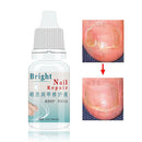 LANTHOME Onychomycosis Curing Nail Foot Whitening Fungus Removal Toe Fungal Nail Treatment 10ml