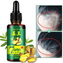 30ml Hair Loss Treatment Ginger Hair Growth Essence Hair Care