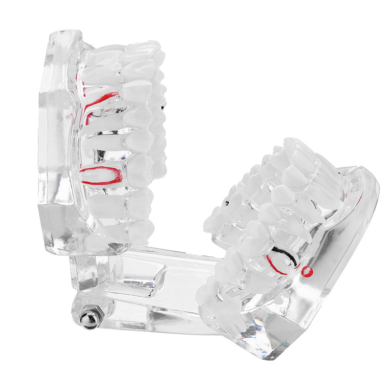 Clear Dental Teeth Study Teaching Model Crystal Typodont Model Removable Teeth Model Medical Model