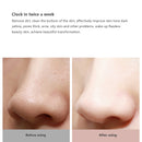 Xiaomi Mijia Youpin Wellskins Electric Blackhead Suction Cleaner Apparatus to Blackhead Cosmetology Apparatus to Wash Pore Cleaner