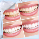 Oral Cleaning Teeth Whitening Tools Kit Nano Brush Tooth Stains Remover Burnish 2pcs Cleaning Sticks & 5pcs Cotton Strips