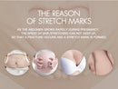Rosalind Dilute Scar Acne Scars Stretch Marks To Stretch Marks Cream