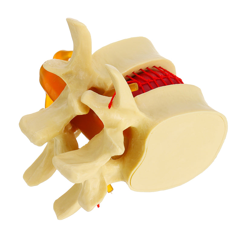 Anatomical Human Skeleton Spine Lumbar Vertebrae Degenerative Disc Medical Model