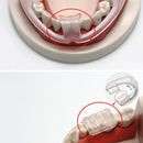 Molar Pads Anti-Grinding Orthodontic Brace Sleeping Wear-Resistant Teeth Braces Health Teeth Care Dental Tools