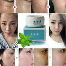 Suction Spot Cream Face Care Whitening Remove Freckle Dark Spots Scar Whitening Cream